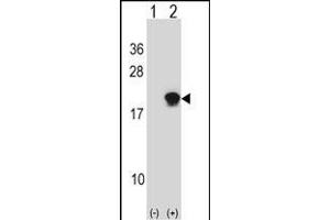 Western blot analysis of SUMO4 (arrow) using rabbit polyclonal SUMO4 Antibody (Center) (ABIN388077 and ABIN2845831). (SUMO4 anticorps)