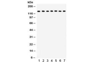 Western blot testing of 1) rat lung, 2) mouse lung, 3) HeLa, 4) MM231, 5) COLO320, 6) A549 and 7) mouse NIH3T3 lysate with SAP97 antibody. (DLG1 anticorps  (AA 1-165))