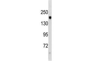 TSC1 antibody western blot analysis in mouse liver tissue lysate (TSC1 anticorps  (AA 1117-1144))