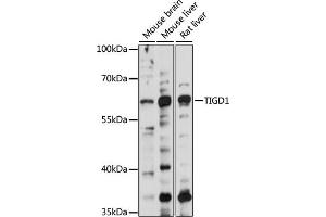 Western blot analysis of extracts of various cell lines, using TIGD1 antibody (ABIN7270828) at 1000 dilution. (TIGD1 anticorps  (AA 1-300))