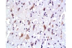 Formalin-fixed and paraffin embedded: rat brain tissue labeled with Anti-PKB Polyclonal Antibody, Unconjugated 1:200 followed by conjugation to the secondary antibody and DAB staining (AKT1/3 (AA 401-479) anticorps)
