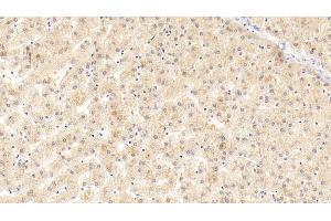 Detection of APOA4 in Human Liver Tissue using Polyclonal Antibody to Apolipoprotein A4 (APOA4)