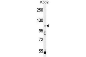 AGBL5 Antibody (N-term) western blot analysis in K562 cell line lysates (35µg/lane). (AGBL5 anticorps  (N-Term))