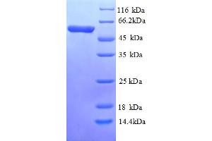 SDS-PAGE (SDS) image for Cell Division Cycle 25 Homolog C (S. Pombe) (CDC25C) (AA 1-473), (full length) protein (His tag) (ABIN5709257)