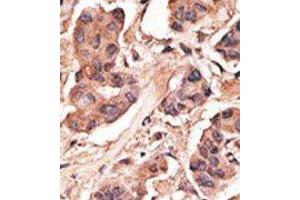 Image no. 2 for anti-Melanoma Antigen Family H, 1 (MAGEH1) (C-Term) antibody (ABIN358661) (MAGEH1 anticorps  (C-Term))