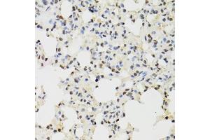 Immunohistochemistry of paraffin-embedded mouse lung using KDM4A antibody (ABIN6131821, ABIN6142793, ABIN6142795 and ABIN6223960) at dilution of 1:100 (40x lens). (KDM4A anticorps  (AA 585-815))