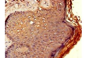Immunohistochemistry of paraffin-embedded human skin tissue using ABIN7167421 at dilution of 1:100