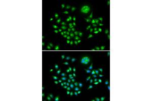 Immunofluorescence analysis of HeLa cells using AGFG1 antibody (ABIN6293682). (AGFG1 anticorps)