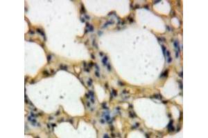 Used in DAB staining on fromalin fixed paraffin-embedded Lung tissue (TICAM2 anticorps  (AA 34-241))
