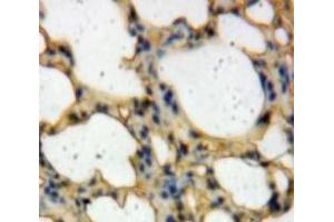 Used in DAB staining on fromalin fixed paraffin-embedded Lung tissue