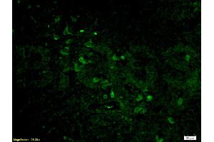 Formalin-fixed and paraffin-embedded rat brain labeled with Anti-Histone H3 Polyclonal Antibody, Unconjugated (ABIN739109) 1:200, overnight at 4°C, The secondary antibody was Goat Anti-Rabbit IgG, Cy3 conjugated used at 1:200 dilution for 40 minutes at 37°C.