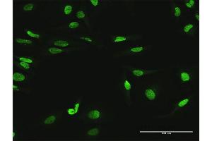 Immunofluorescence of purified MaxPab antibody to MYNN on HeLa cell. (Myoneurin anticorps  (AA 1-610))