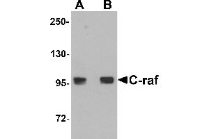 Western blot analysis of C-raf in 3T3 cell lysate with C-raf antibody at (A) 0. (RAF1 anticorps  (N-Term))