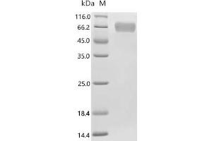 (Tris-Glycine gel) Discontinuous SDS-PAGE (reduced) with 5 % enrichment gel and 15 % separation gel.