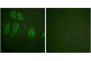 Immunofluorescence analysis of HeLa cells, using IL-2R alpha/CD25 (Ab-268) Antibody. (CD25 anticorps  (AA 223-272))