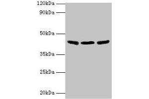 Western blot All lanes: IDH3B antibody at 2 μg/mL Lane 1: Hela whole cell lysate Lane 2: Mouse kidney tissue Lane 3: Mouse gonadal tissue Secondary Goat polyclonal to rabbit IgG at 1/10000 dilution Predicted band size: 43, 42, 26 kDa Observed band size: 43 kDa (IDH3B anticorps  (AA 35-385))