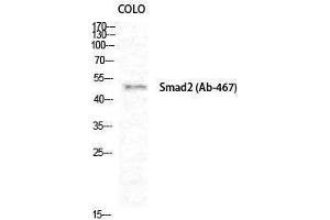 Western Blotting (WB) image for anti-SMAD, Mothers Against DPP Homolog 2 (SMAD2) (Ser80) antibody (ABIN3186987)