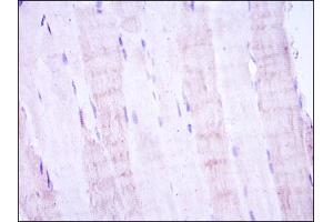Immunohistochemical analysis of paraffin-embedded muscle tissues using MAP2K4 mouse mAb with DAB staining.
