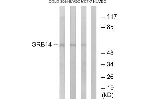 Western blot analysis of extracts from COLO cells, HUVEC cells and MCF-7 cells, using GRB14 antibody. (GRB14 anticorps  (Internal Region))