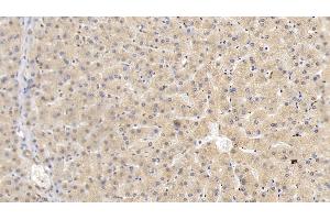 Detection of HRG in Human Liver Tissue using Monoclonal Antibody to Histidine Rich Glycoprotein (HRG)