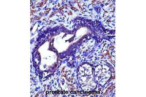 Immunohistochemistry (IHC) image for anti-Actin, gamma 2, Smooth Muscle, Enteric (ACTG2) antibody (ABIN2997383)