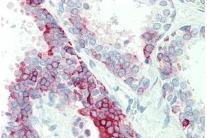 Human, Prostate: Formalin-Fixed Paraffin-Embedded (FFPE)