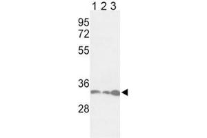 Western blot analysis of anti-PCNA antibody and Jurkat (lane 1), HeLa (2), 293 (3) lysate (PCNA anticorps  (AA 89-117))