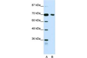 Western Blotting (WB) image for anti-Tripartite Motif Containing 32 (TRIM32) antibody (ABIN2461827) (TRIM32 anticorps)