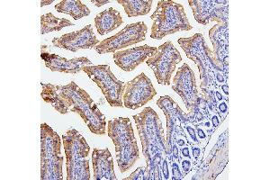 IHC analysis of CEACAM5 using anti-CEACAM5 antibody (ABIN7601435). (CEACAM5 anticorps  (AA 35-650))