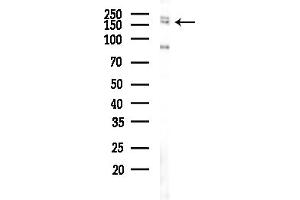 Western blot analysis of lysates from COLO205 cells(UV,30 min treatment), using EIF3A Antibody at 1/1000 dilution.