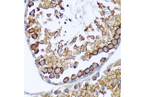 Immunohistochemistry of paraffin-embedded rat testis using T Rabbit mAb (ABIN7270916) at dilution of 1:100 (40x lens).