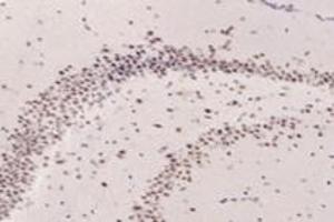 Immunohistochemistry analysis of paraffin-embedded rat hippocampus using,TADA2B (ABIN7075957) at dilution of 1: 3200