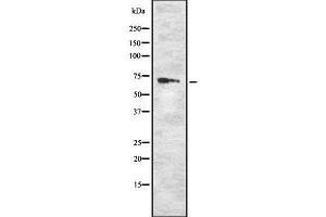 Western blot analysis of RYK using K562 whole cell lysates (RYK anticorps  (Internal Region))
