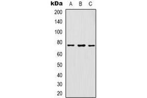 Western blot analysis of GAB1 expression in K562 (A), HepG2 (B), NIH3T3 (C) whole cell lysates. (GAB1 anticorps  (C-Term))