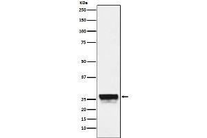 Western blot analysis of CTRL expression in Mouse pancreas lysate.