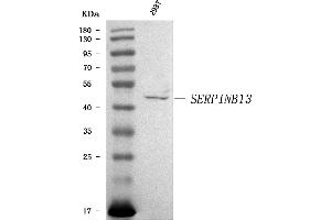 Western blot analysis of SERPINB13 using anti-SERPINB13 antibody (ABIN7599316).
