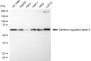 Western blotting analysis using interferon regulatory factor 6 antibody (ABIN7799087).