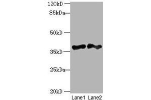 Western blot All lanes: DNAJB4 antibody at 2 μg/mL Lane 1: Hela whole cell lysate Lane 2: Mouse heart tissue Secondary Goat polyclonal to rabbit IgG at 1/10000 dilution Predicted band size: 38 kDa Observed band size: 38 kDa
