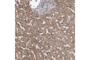Immunohistochemical staining of human liver with MED12L polyclonal antibody  shows moderate cytoplasmic and nucleolar positivity in hepatocytes at 1:50-1:200 dilution. (MED12L anticorps)
