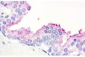 Image no. 1 for anti-G Protein-Coupled Receptor 21 (GPR21) (Cytoplasmic Domain) antibody (ABIN1048777)