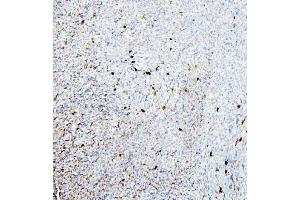 IHC analysis of ALDH1A1 using anti-ALDH1A1 antibody (ABIN7602127). (ALDH1A1 anticorps  (AA 6-342))