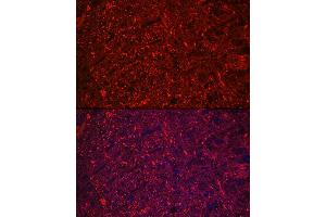 Immunofluorescence analysis of rat brain using Neurofilament L Rabbit mAb (ABIN7268867) at dilution of 1:100 (40x lens). (NEFL anticorps)