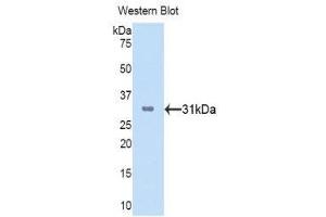 Western Blotting (WB) image for anti-Cathepsin K (CTSK) (AA 115-329) antibody (ABIN3201849)