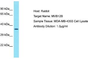 Host: Rabbit Target Name: MVB12B Sample Tissue: Human MDA-MB-435S Whole Cell Antibody Dilution: 1ug/ml (MVB12B anticorps  (C-Term))
