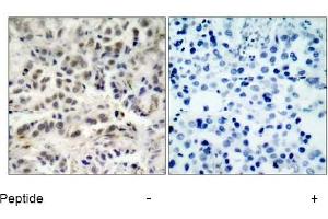 Image no. 1 for anti-Cyclin-Dependent Kinase Inhibitor 1B (p27, Kip1) (CDKN1B) (Ser10) antibody (ABIN197350)