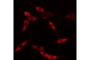 ABIN6275231 staining HuvEc cells by IF/ICC. (MAP9 anticorps  (N-Term))