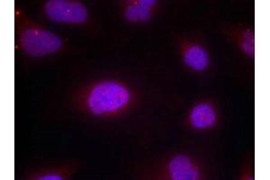 Immunofluorescence staining of methanol-fixed Hela cells using Cyclin B1(phospho-Ser147) Antibody. (Cyclin B1 anticorps  (pSer147))