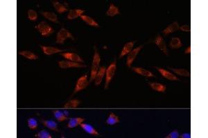 Immunofluorescence analysis of L929 cells using COL4A3 Polyclonal Antibody at dilution of 1:100. (COL4a3 anticorps)