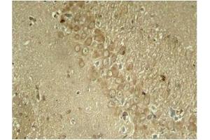 Image no. 1 for anti-Microtubule-Associated Protein tau (MAPT) (pSer262) antibody (ABIN196808) (MAPT anticorps  (pSer262))