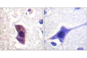 Immunohistochemistry analysis of paraffin-embedded human brain, using HRS (Phospho-Tyr334) Antibody.